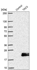 NKB Antibody in Western Blot (WB)