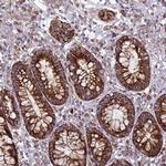 FSTL4 Antibody in Immunohistochemistry (Paraffin) (IHC (P))