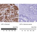 LIPF Antibody in Immunohistochemistry (IHC)