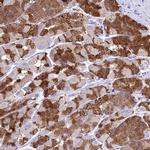 LIPF Antibody in Immunohistochemistry (IHC)