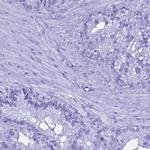 LIPF Antibody in Immunohistochemistry (IHC)