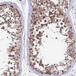 RNF121 Antibody in Immunohistochemistry (IHC)