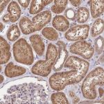 NPHP1 Antibody in Immunohistochemistry (Paraffin) (IHC (P))