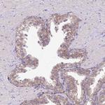 NPHP1 Antibody in Immunohistochemistry (Paraffin) (IHC (P))