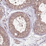 NPHP1 Antibody in Immunohistochemistry (Paraffin) (IHC (P))