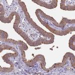 NPHP1 Antibody in Immunohistochemistry (IHC)