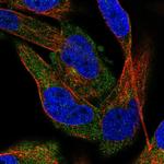 C2CD5 Antibody in Immunocytochemistry (ICC/IF)