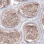 SKOR2 Antibody in Immunohistochemistry (IHC)