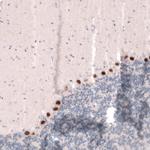 SKOR2 Antibody in Immunohistochemistry (IHC)