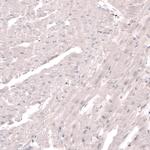 SKOR2 Antibody in Immunohistochemistry (IHC)