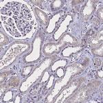 SV2B Antibody in Immunohistochemistry (Paraffin) (IHC (P))