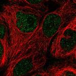 GCHFR Antibody in Immunocytochemistry (ICC/IF)