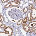 GCHFR Antibody in Immunohistochemistry (Paraffin) (IHC (P))