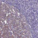 GCHFR Antibody in Immunohistochemistry (Paraffin) (IHC (P))