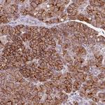 Aquaporin 8 Antibody in Immunohistochemistry (Paraffin) (IHC (P))