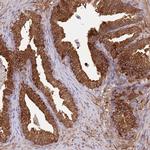 ALDH1A3 Antibody in Immunohistochemistry (Paraffin) (IHC (P))