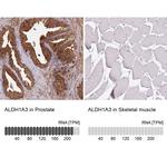 ALDH1A3 Antibody in Immunohistochemistry (IHC)