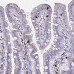 GNG13 Antibody in Immunohistochemistry (Paraffin) (IHC (P))