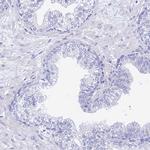 GNG13 Antibody in Immunohistochemistry (Paraffin) (IHC (P))