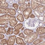 PGM1 Antibody in Immunohistochemistry (Paraffin) (IHC (P))