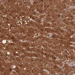 PGM1 Antibody in Immunohistochemistry (Paraffin) (IHC (P))