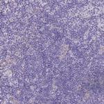 PGM1 Antibody in Immunohistochemistry (Paraffin) (IHC (P))