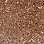 PGM1 Antibody in Immunohistochemistry (IHC)