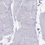 FUCA1 Antibody in Immunohistochemistry (IHC)