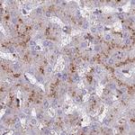 FUCA1 Antibody in Immunohistochemistry (IHC)