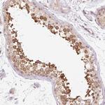 Gemin 2 Antibody in Immunohistochemistry (Paraffin) (IHC (P))