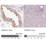 Gemin 2 Antibody in Immunohistochemistry (IHC)