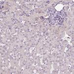 Gemin 2 Antibody in Immunohistochemistry (IHC)