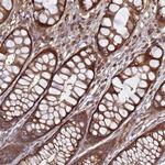 CNOT1 Antibody in Immunohistochemistry (Paraffin) (IHC (P))