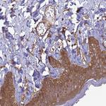 CNOT1 Antibody in Immunohistochemistry (Paraffin) (IHC (P))