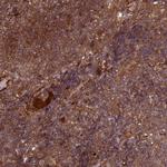 CNOT1 Antibody in Immunohistochemistry (Paraffin) (IHC (P))