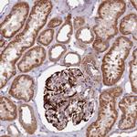 Alsin Antibody in Immunohistochemistry (Paraffin) (IHC (P))