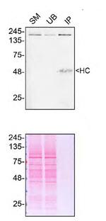 Alsin Antibody in Immunoprecipitation (IP)