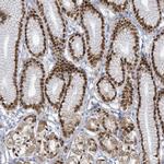 ZFPM1 Antibody in Immunohistochemistry (Paraffin) (IHC (P))