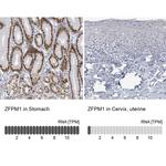 ZFPM1 Antibody in Immunohistochemistry (IHC)