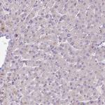 SCAMP5 Antibody in Immunohistochemistry (Paraffin) (IHC (P))