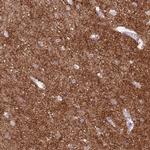 SCAMP5 Antibody in Immunohistochemistry (IHC)