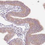 FLVCR1 Antibody in Immunohistochemistry (Paraffin) (IHC (P))