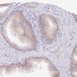 FLVCR1 Antibody in Immunohistochemistry (Paraffin) (IHC (P))