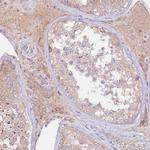 FLVCR1 Antibody in Immunohistochemistry (Paraffin) (IHC (P))