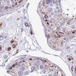 SUCLG2 Antibody in Immunohistochemistry (IHC)