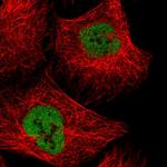 NXF3 Antibody in Immunocytochemistry (ICC/IF)