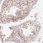 NXF3 Antibody in Immunohistochemistry (IHC)