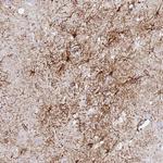 FMN1 Antibody in Immunohistochemistry (Paraffin) (IHC (P))