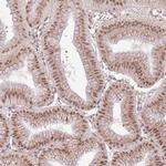 POLR3H Antibody in Immunohistochemistry (Paraffin) (IHC (P))