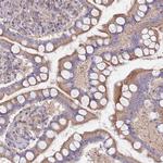 MALRD1 Antibody in Immunohistochemistry (Paraffin) (IHC (P))